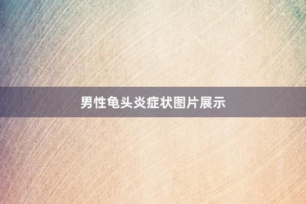 男性龟头炎症状图片展示
